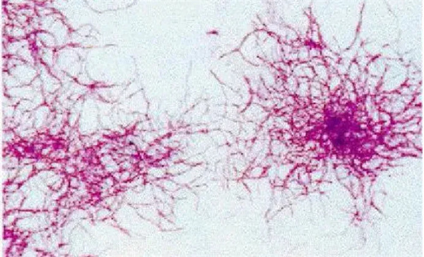 How to improve the nitrogen and phosphorus removal effect in low temperature environment?