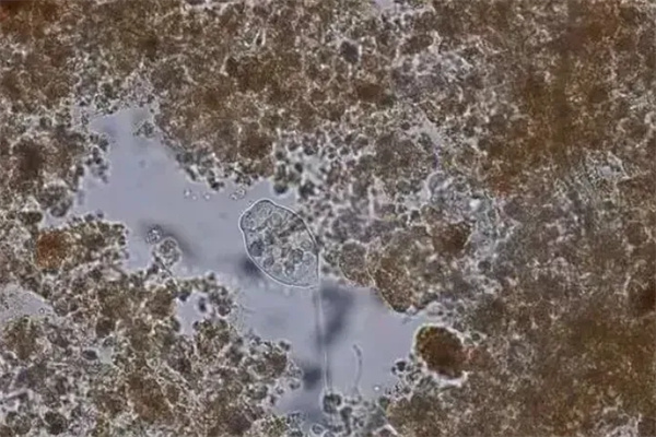 How to improve the nitrogen and phosphorus removal effect in low temperature environment?